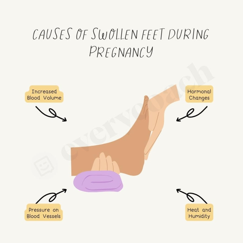 Causes Of Swollen Feet During Pregnancy Instagram Post Canva Template ...