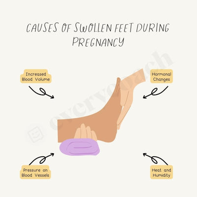 Causes Of Swollen Feet During Pregnancy Instagram Post Canva Template