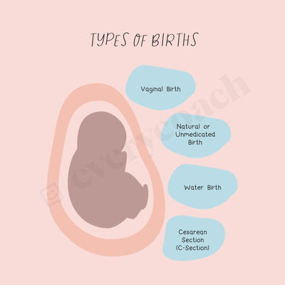 Types Of Births Instagram Post Canva Template