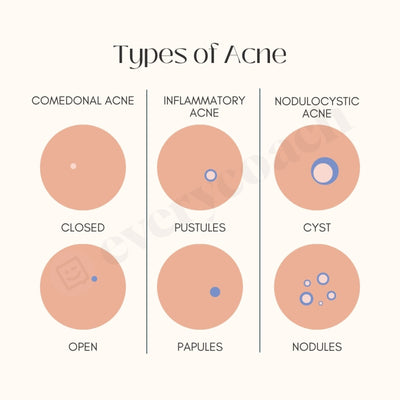 Types Of Acne Instagram Post Canva Template
